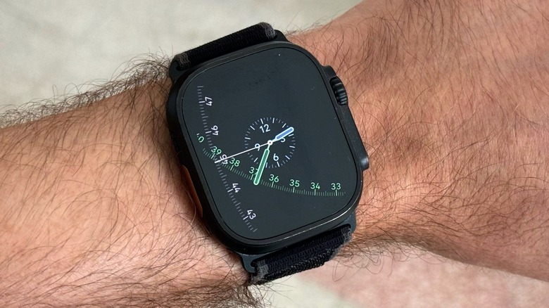 Apple Watch running watchOS 26.2