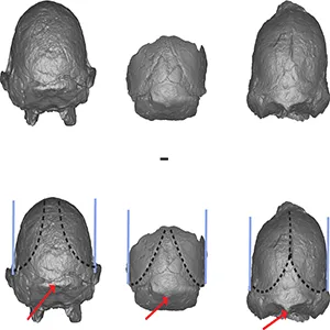 Little foot fossil, possible human ancestor, CT scans. Sts 5, MLD 1, StW 573 positioned in Frankfurt Horizontal in posterior view. Black dotted line demonstrates the configuration of the superior temporal lines, the red arrow indicates the configuration of the external occipital protuberance, and the blue line demonstrates the slope of the parietals relative to a vertical plane. Credit: La Trobe University