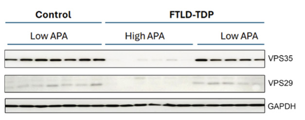 In TDP-43 Proteinopathy, Misplaced PolyA Tails Mean Crippled Retromers