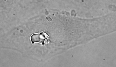 Elephant in the (tiny) room