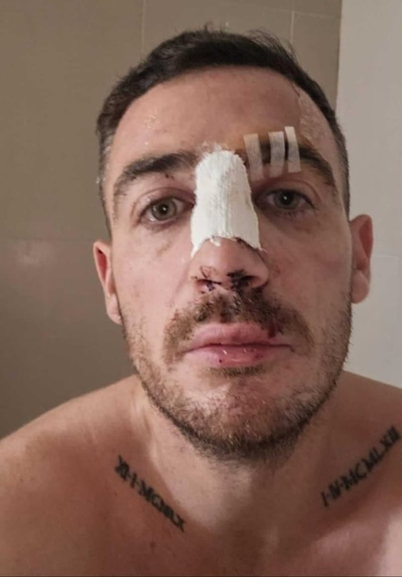 Chris Jenkins: ‘My nose collapsed and my septum is permanently damaged internally and I’ve lost three teeth, all due to cocaine use.’