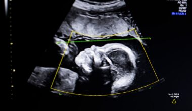 BioticsAI, which won Disrupt's Battlefield competition in 2023, gains FDA approval for its AI-powered fetal ultrasound product 