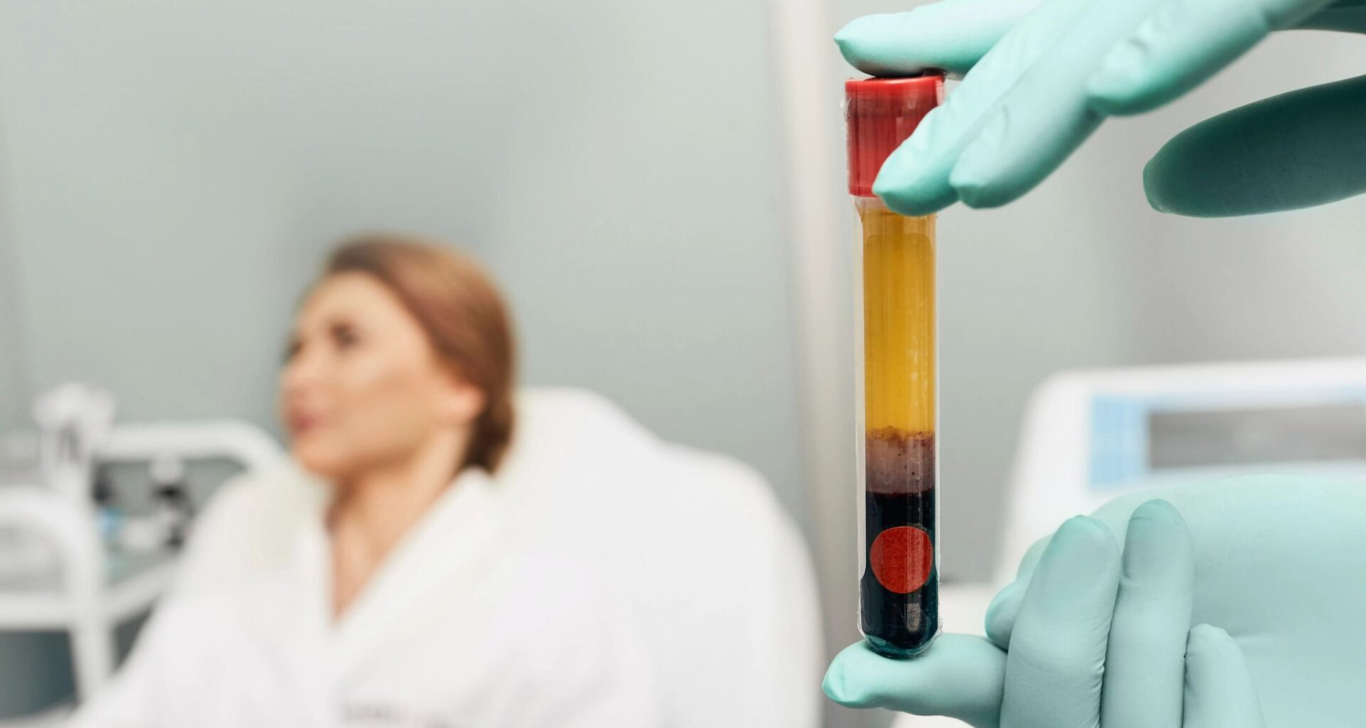 Platelet-Rich Plasma (PRP) Therapy: Benefits and Risks