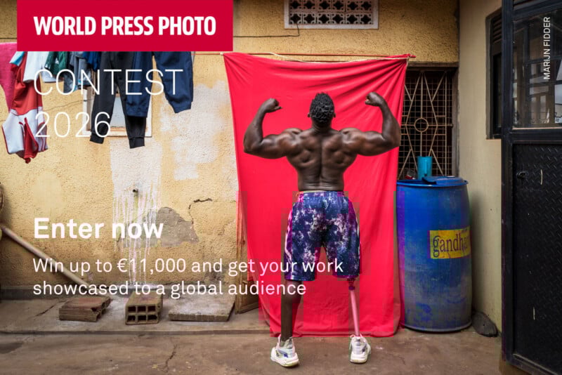 A man with a prosthetic leg poses with flexed arms in front of a red backdrop outdoors. Text promotes the World Press Photo Contest 2026, inviting entries to win up to €11,000 and global exposure.