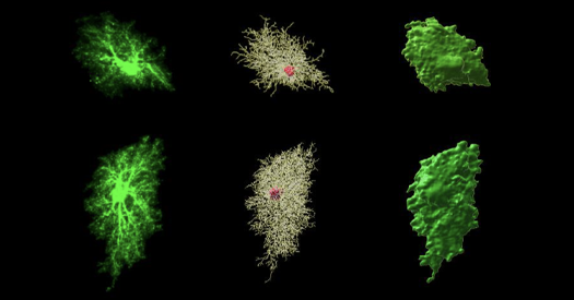 Alzheimer’s disease and autism; and more