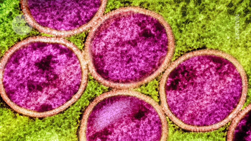 Will mpox go global again? Research shows it's evolving in curious ways