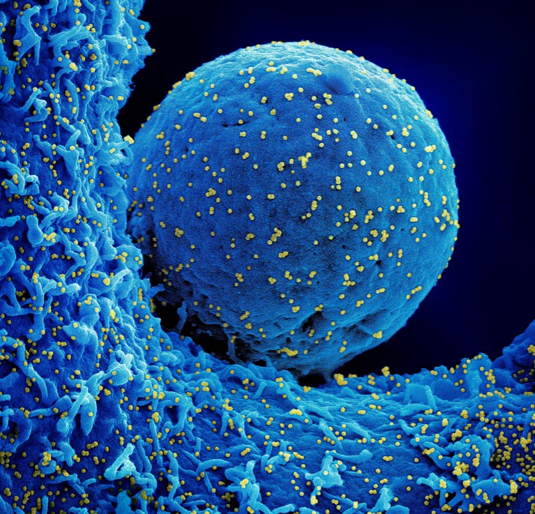 Coloured scanning electron micrograph showing a blue sphere with yellow tiny spots.