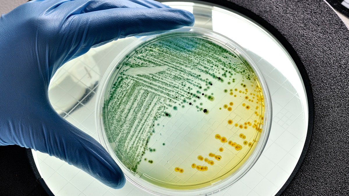 E. coli bacteria growing in laboratory dish 