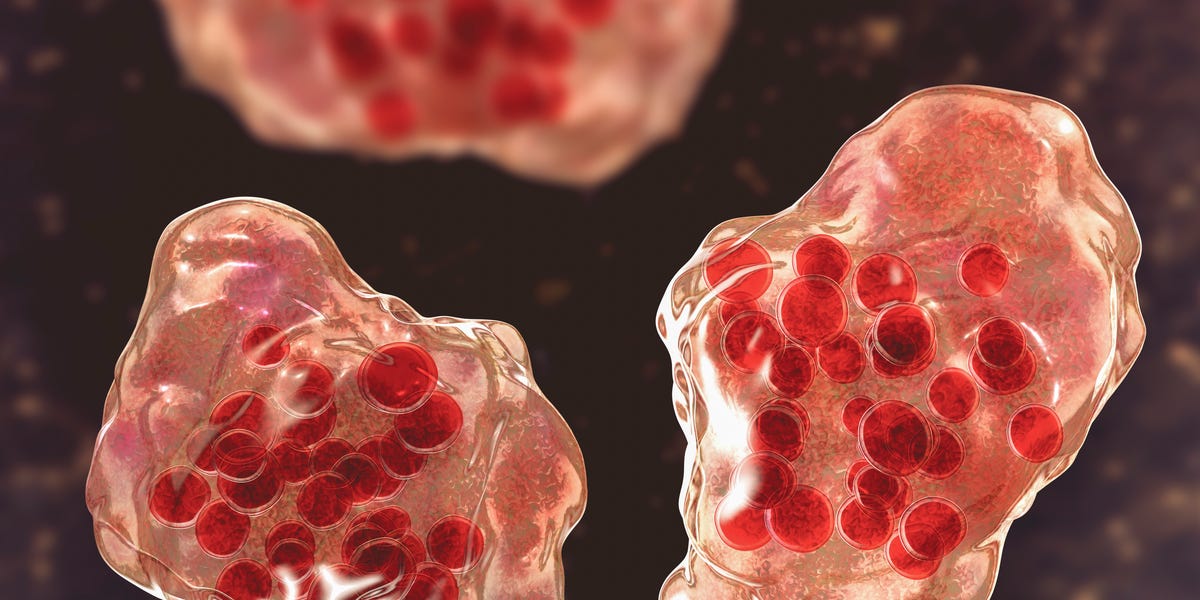 What Doctors Want You to Do After a Measles Exposure