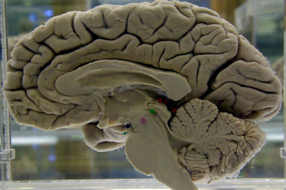 Tips to exercise your brain to lower risk of dementia