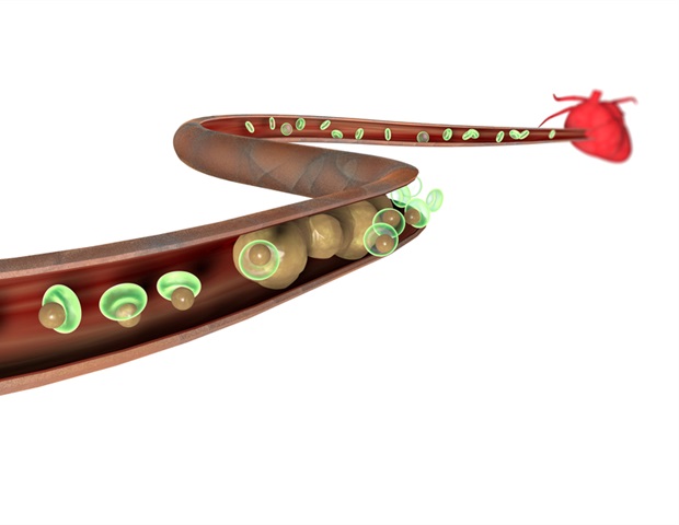 Elevated Lp(a) levels associated with residual cardiovascular risk