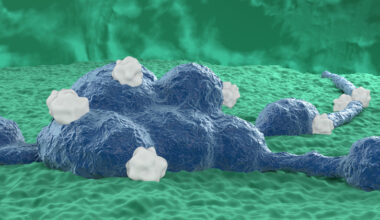 Neuroblastoma tumor cells in central nervous system (brain cancer) - closeup view 3d illustration