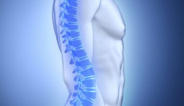 Gut microbiome may determine bone loss severity in primary hyperparathyroidism