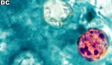 Michigan Cyclosporiasis case numbers jump by over 100 | Health