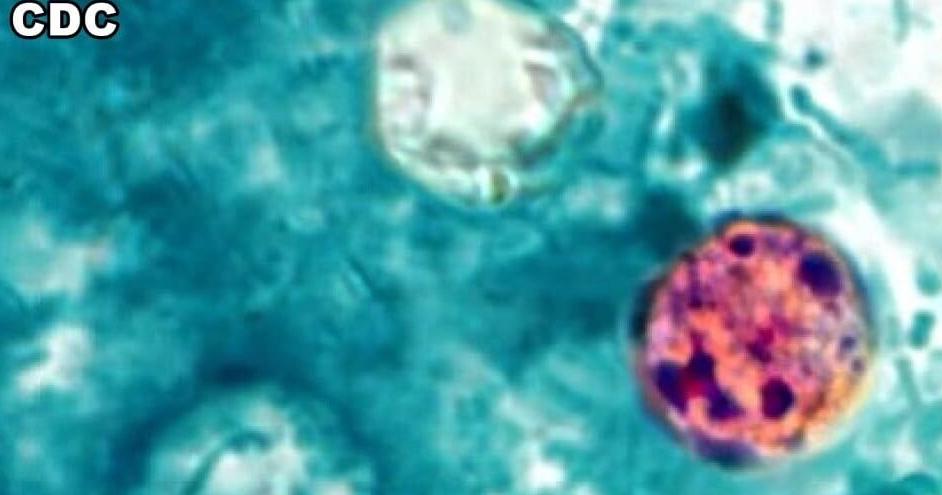 Michigan Cyclosporiasis case numbers jump by over 100 | Health
