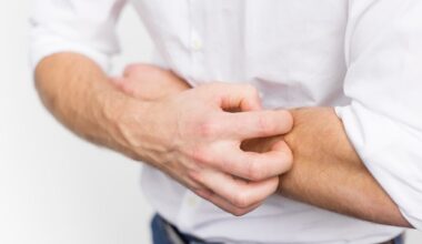Common allergy medications offer no real relief for eczema patients