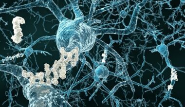 Modern blood thinners slow cognitive decline in Alzheimer's patients