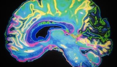 Brain scans reveal language-specific network of neurons even during nonlinguistic tasks