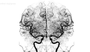 Study: Wake-activated neuronal populations that regulate sleep drive. Image Credit: Radiological imaging / Shutterstock