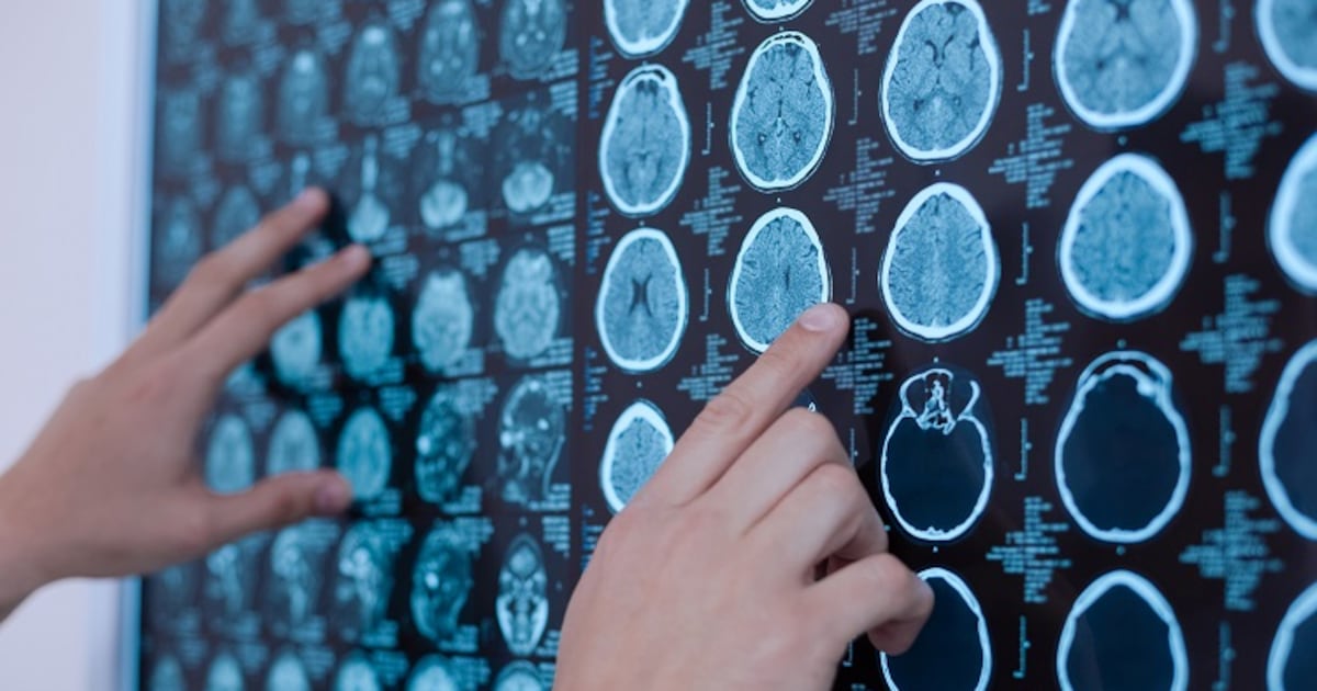 Scallop-derived plasmalogens may support brain health and memory