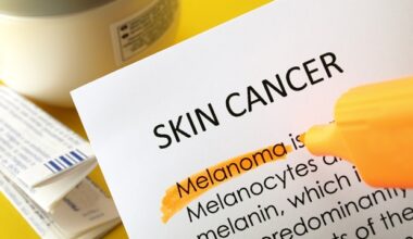 Discovery may help develop new treatments for immunosuppressed skin cancer patients