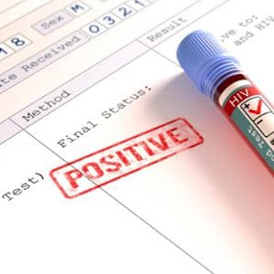 Hiv, l’Ema dà il via libera alla Prep semestrale