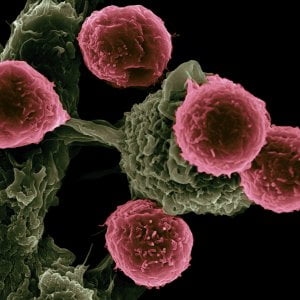Tumore ed Herpes zoster a braccetto, con il cancro aumenta il rischio di infezione