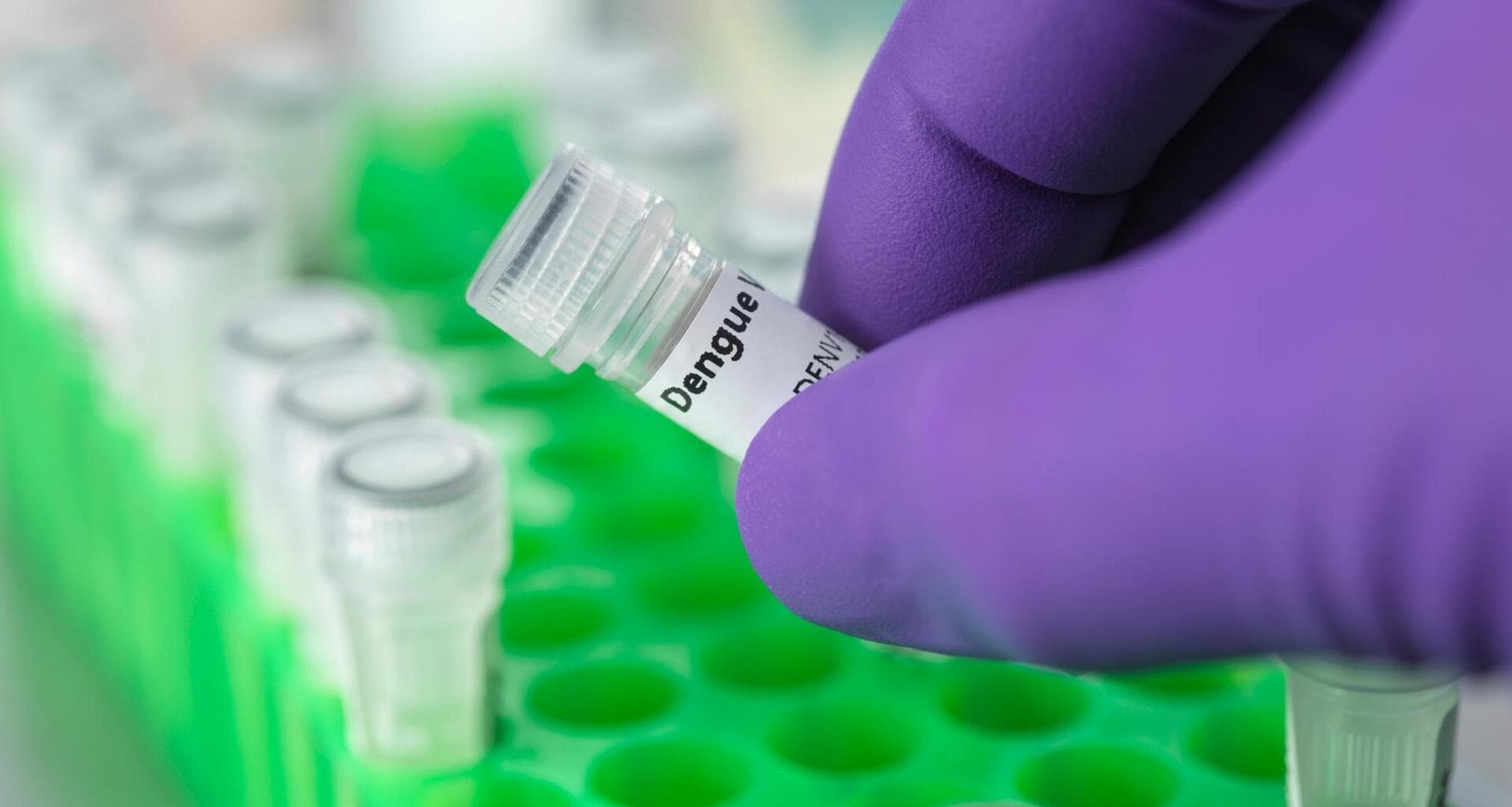 Dengue, individuati gli anticorpi dell’immunità. Saranno utili per farmaci e vaccini