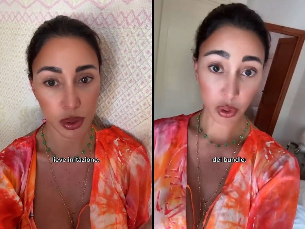 "Cos'ha fatto in faccia?" Bufera social su Belen: cosa è successo