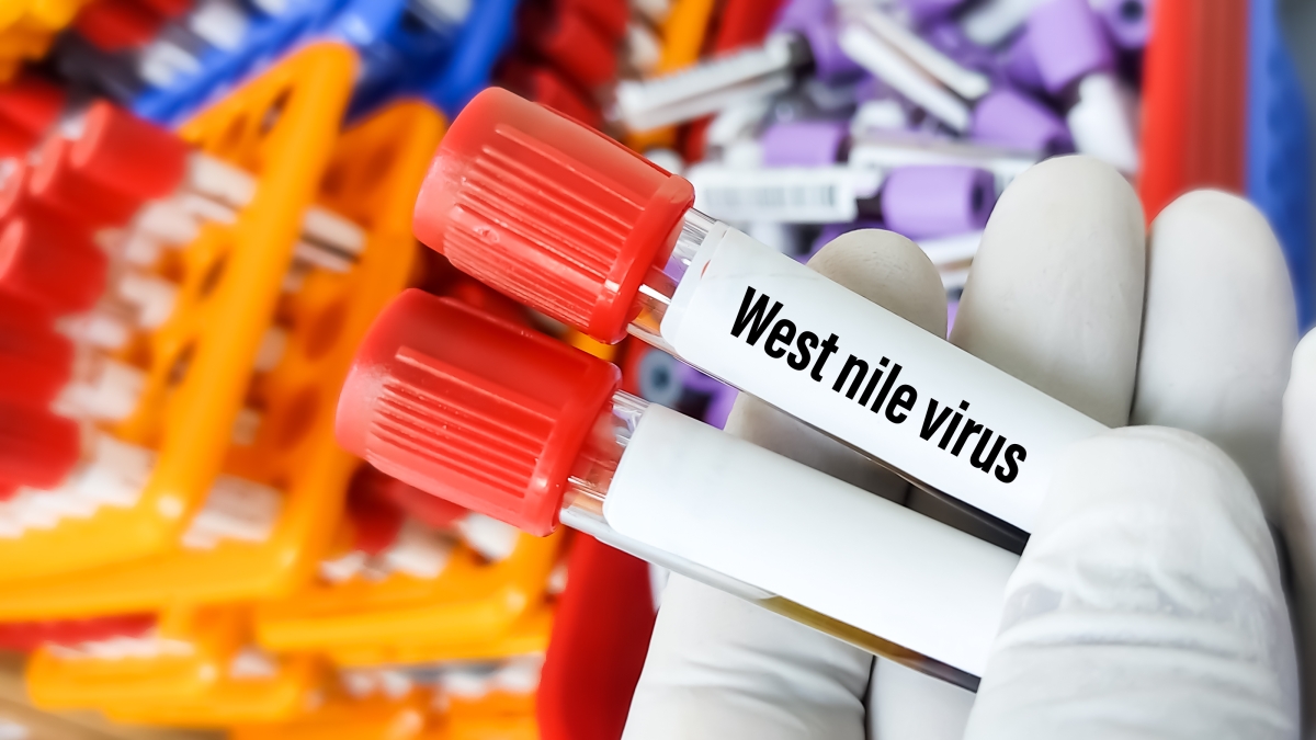 West Nile, l'esperto: «Casi gravi molto rari, ma in presenza di febbre alta o sintomi neurologici bisogna andare in ospedale»