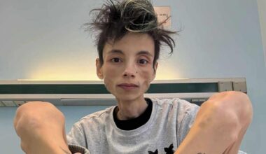 Chi era Thiago Elar, il tiktoker che aveva raccontato la malattia sui social ai suoi quasi 150 mila follower