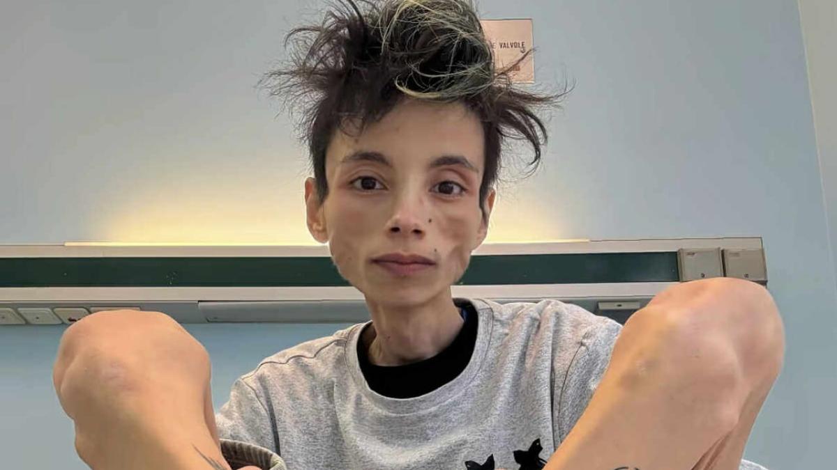 Chi era Thiago Elar, il tiktoker che aveva raccontato la malattia sui social ai suoi quasi 150 mila follower
