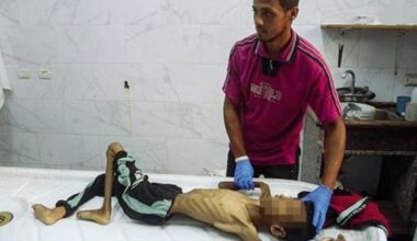 Cibo e aiuti col contagocce, chi li cerca rischia la vita: a Gaza si muore (anche) di fame
