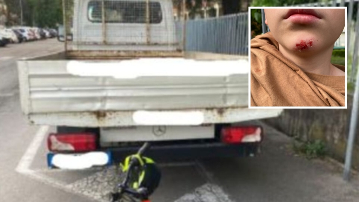 Lainate, parla il papà del bambino caduto in bici: «Ho chiamato i vigili per educare mio figlio al senso civico e hanno multato me»