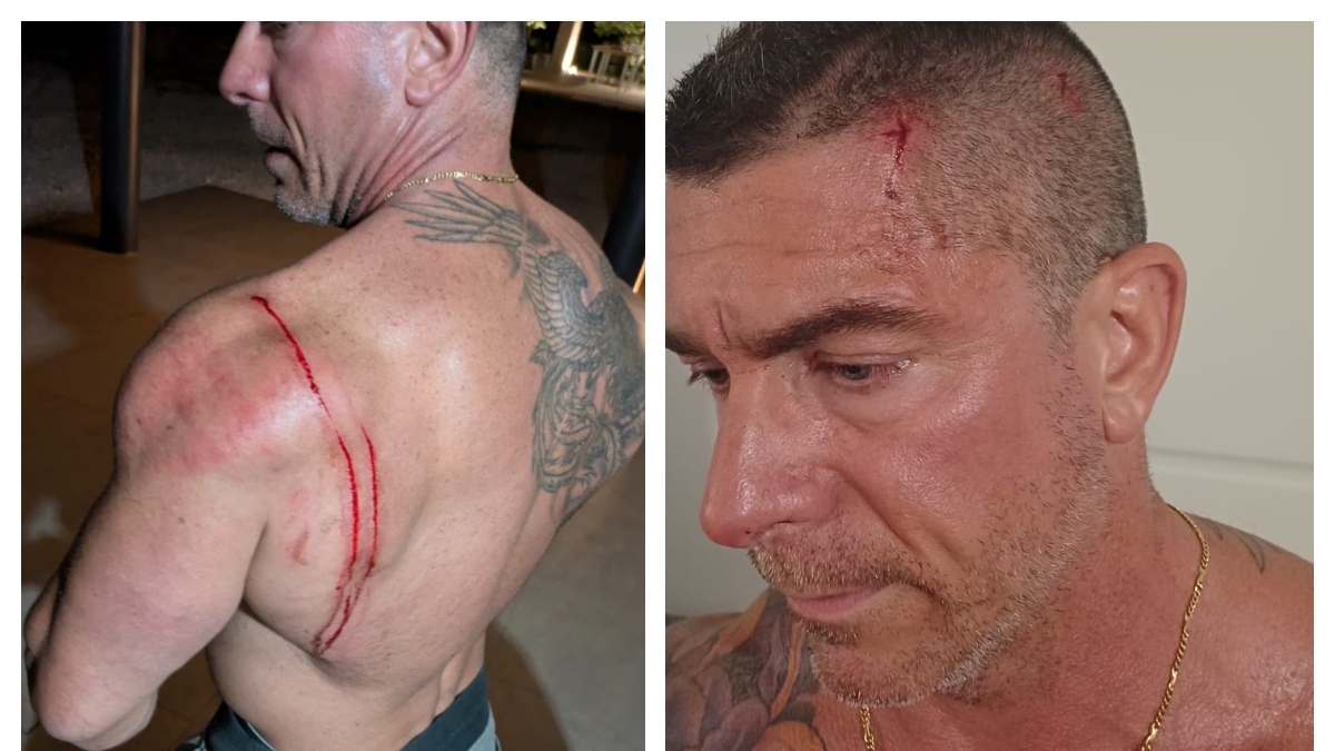 Treviso, affronta i ladri per difendere la madre: body builder professionista pestato a sangue