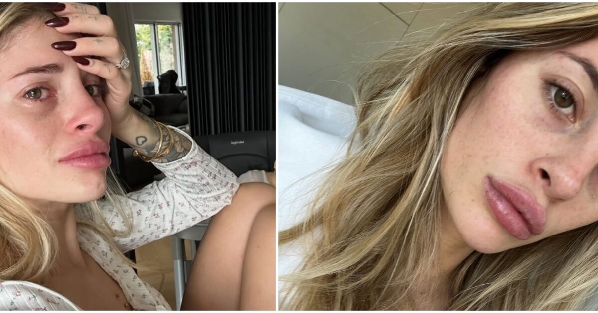 Chiara Nasti in lacrime racconta sui social il lungo calvario dopo il parto