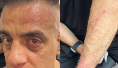 Simone Cicalone aggredito all'esterno della stazione
