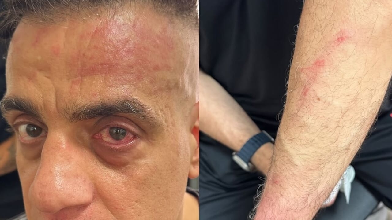 Simone Cicalone aggredito all'esterno della stazione