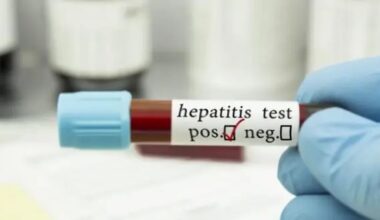 Screening regionale sull'epatite C, circa mille casi su mezzo milione di test