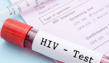 Hiv Aids