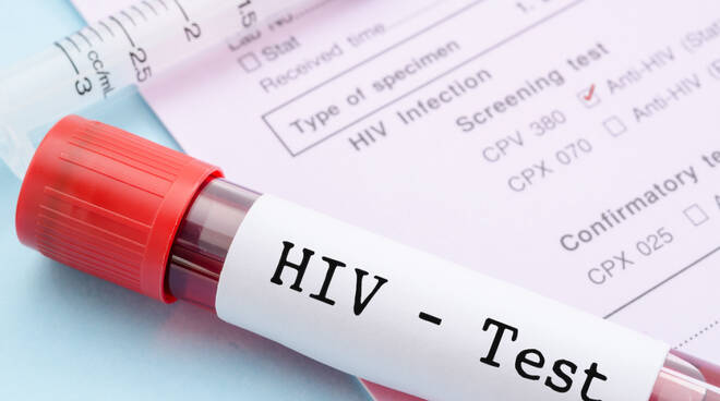 Hiv Aids
