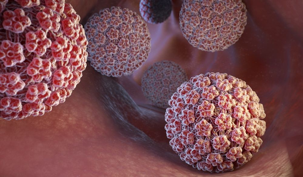 Un vaccino contro il cancro, ma non per tutti
