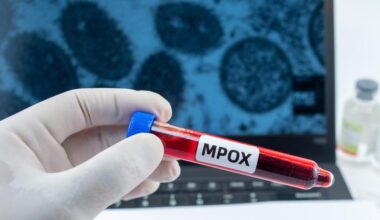 Vaiolo delle scimmie. Giornata di test e vaccini
