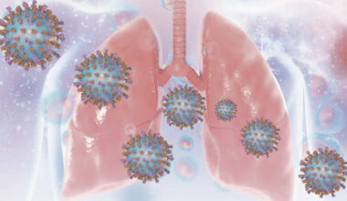 Virus respiratorio sinciziale: online il secondo instant book