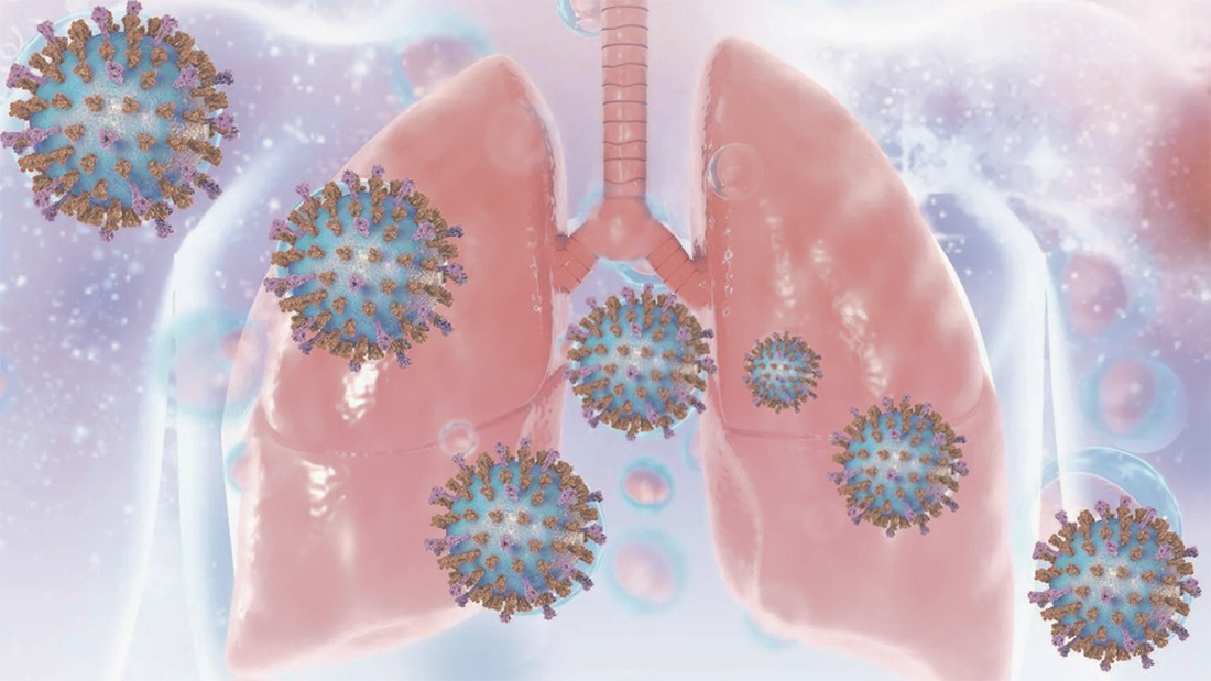 Virus respiratorio sinciziale: online il secondo instant book