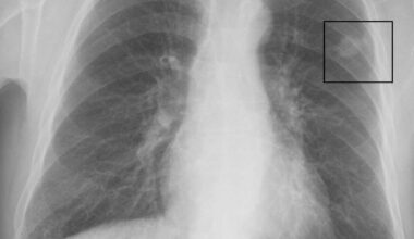 L’importanza della diagnostica nella lotta contro il cancro