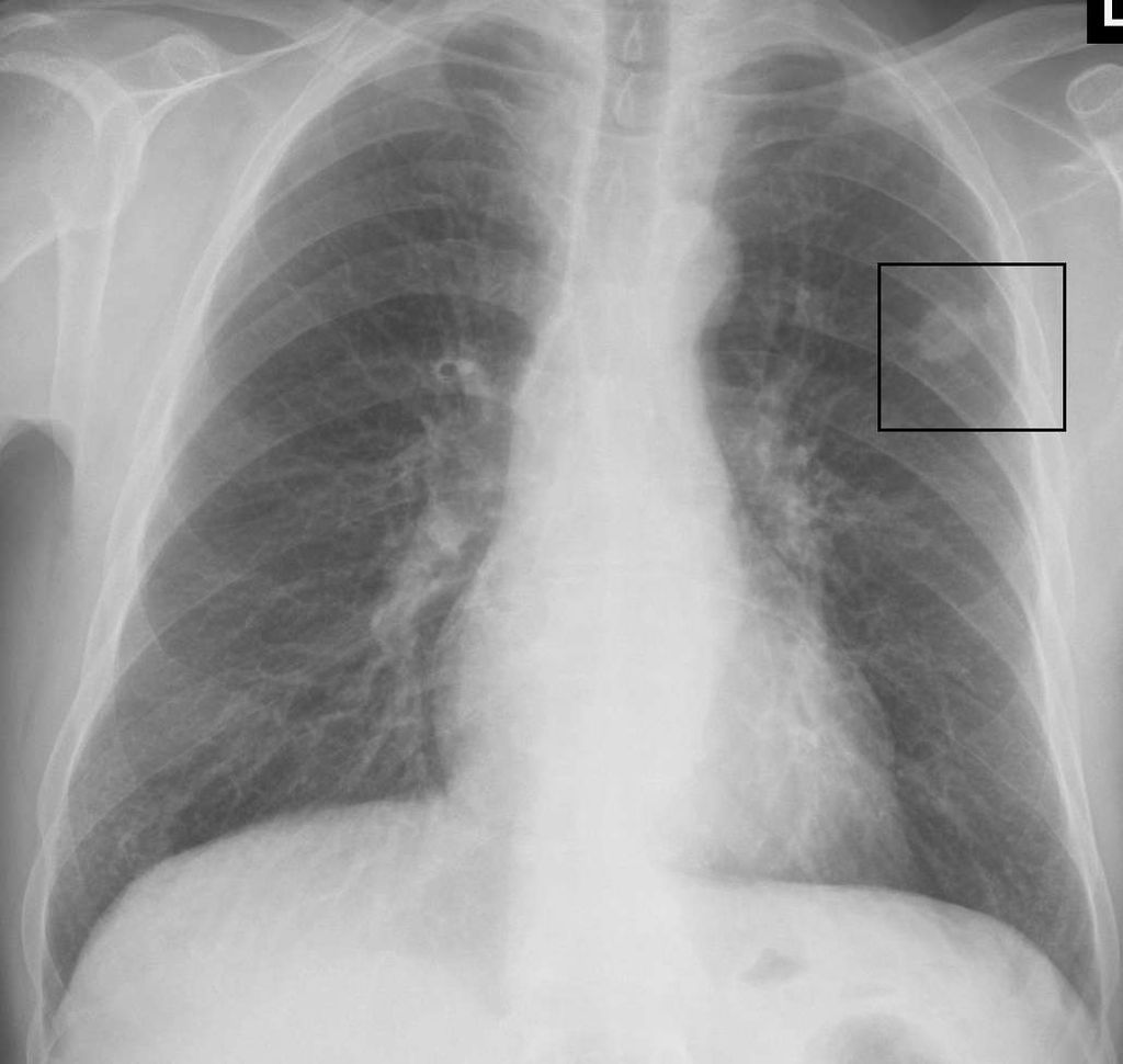 L’importanza della diagnostica nella lotta contro il cancro