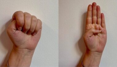 si salva con il segnale antiviolenza