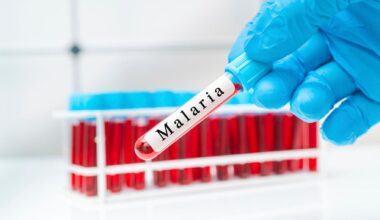 Malaria, scoperto un nuovo bersaglio per vaccini che bloccano la trasmissione