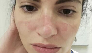 Martina Benedetti: “In corsia ho sfidato il Covid. Folle boicottare i vaccini per qualche voto”